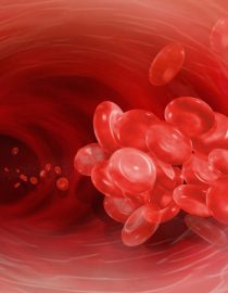 What Are the Risks of Blood Clots and RA What Are the Risks of Blood Clots and RA