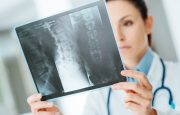 Preventing Falls with Rheumatoid Arthritis