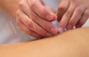 Acupuncture and Acupressure for Rheumatoid Arthritis