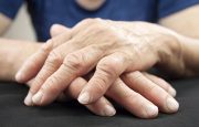 Migratory Arthritis