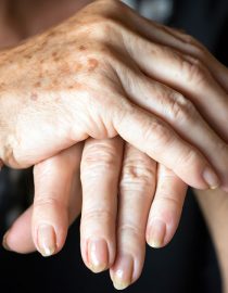 Keeping Your Fingers Limber Despite Arthritis Keeping Your Fingers Limber Despite Arthritis
