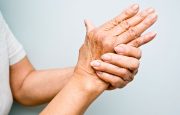 Joint Deformities in Rheumatoid Arthritis