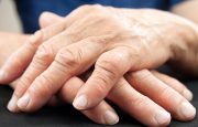 rheumatoid arthritis facts