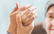 Treatment for RA