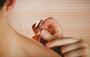 Acupuncture for Rheumatoid Arthritis