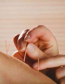 Can Acupuncture Help With Rheumatoid Arthritis Pain? Can Acupuncture Help With Rheumatoid Arthritis Pain?